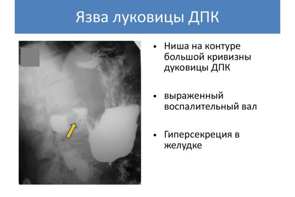 Работающий сайт кракен